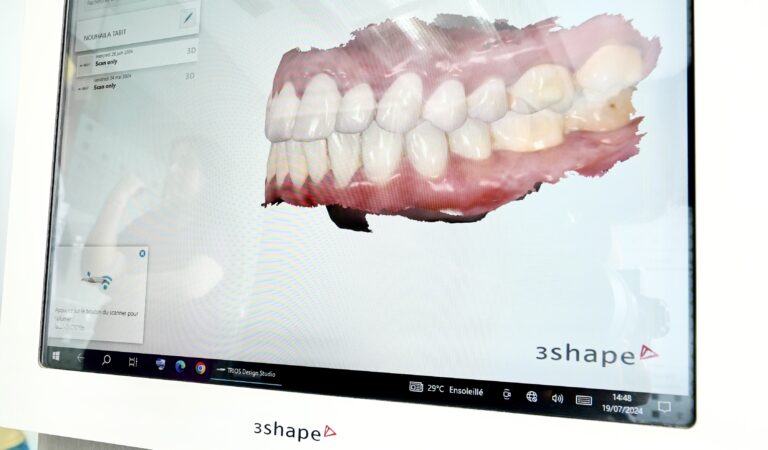 Scanner 3D Casablanca Dentisterie 3D à Casablanca