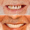 Implant dentaire Clinique dentaire internationale casablanca